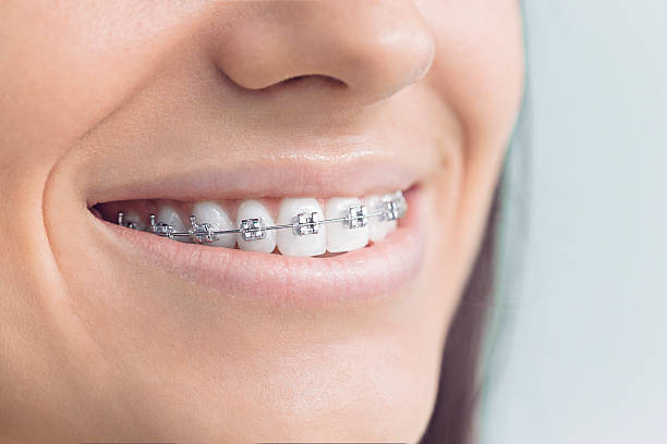 Best Veneers and Lumineers  in Mound Bayou, MS